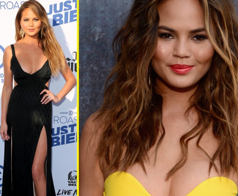 Hollywood Stars With Plastic Surgery