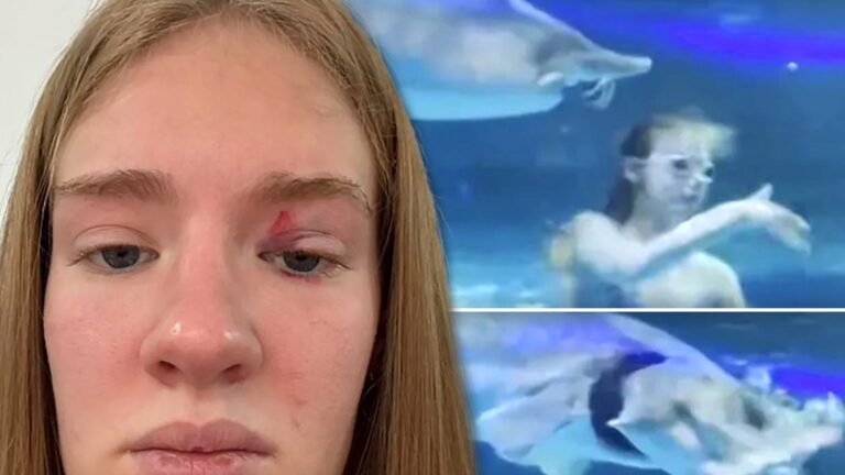 Mermaid Performer Says She Was Rushed to Hospital