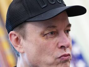 Elon Musk breaks silence on black eye | Elon Musk News