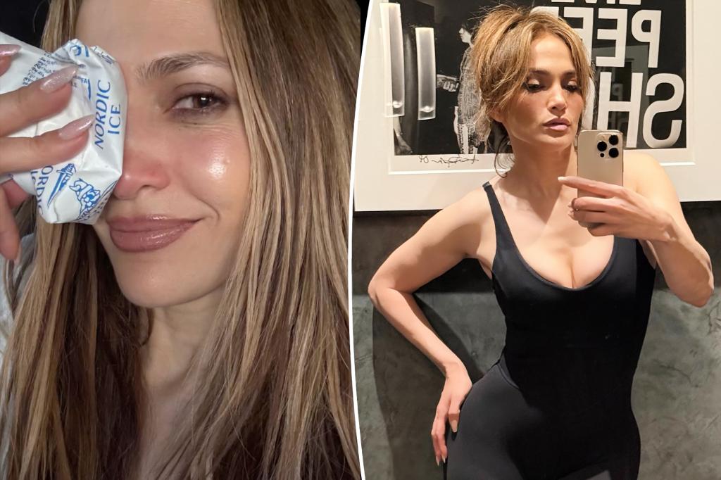 Jennifer Lopez cuts her face rehearsing for 2025 | Gossip Wire