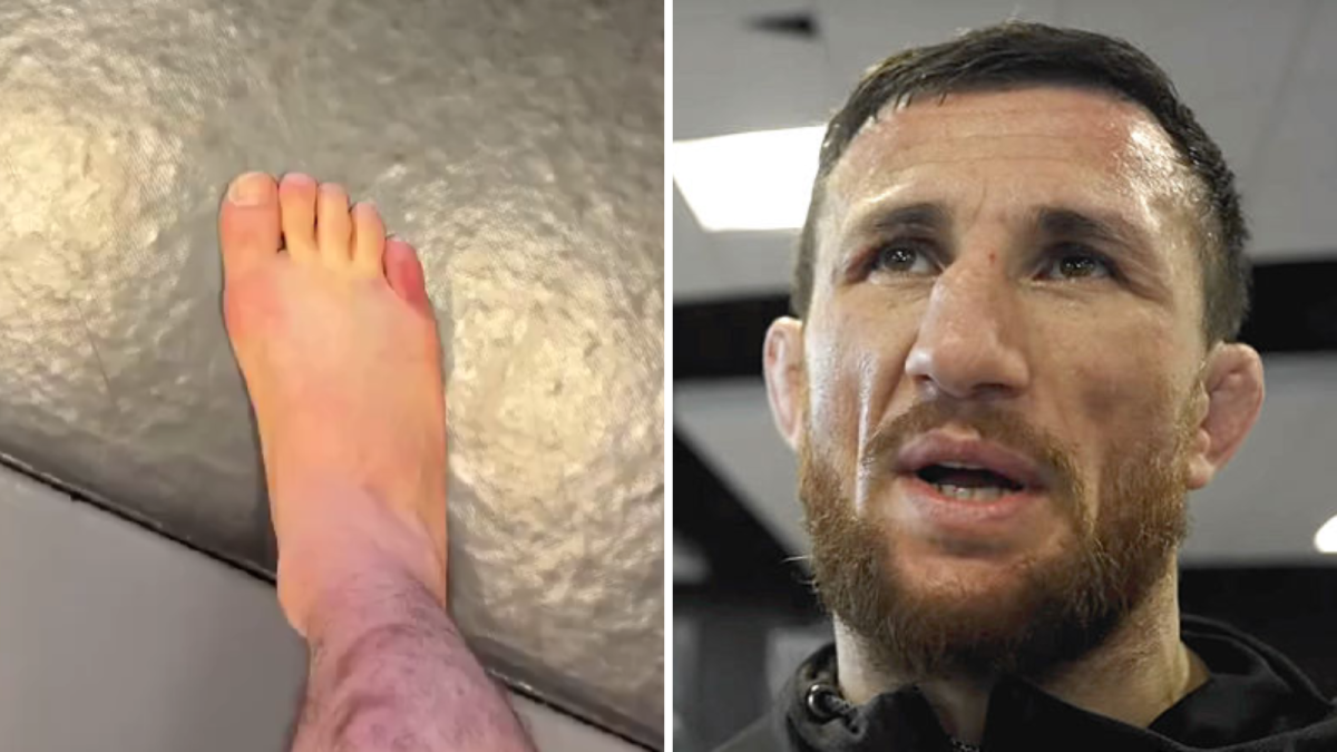 Merab Dvalishvili suffers broken foot days before | MMA News