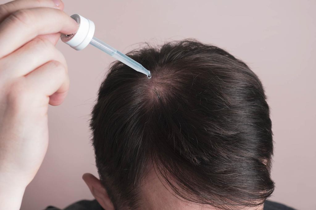 My best friend has been regrowing his hair behind | Lifestyle News