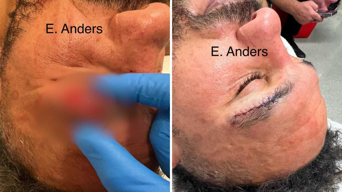 Dana White posts graphic photo of injury caused by