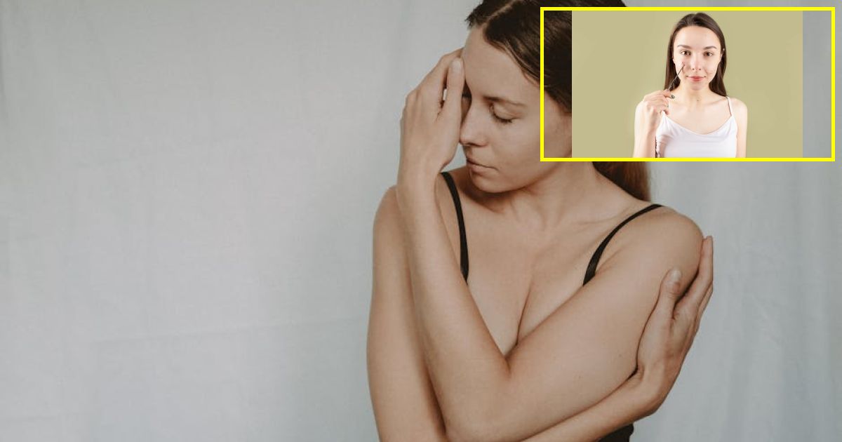 Common skin problem could be a sign of Vitamin B12 deficiency - Health...