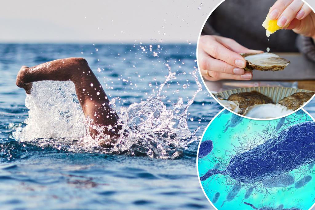 How to protect yourself against flesh-eating | Lifestyle News