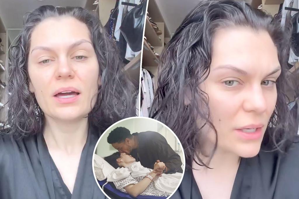 Jessie J reveals her hair is falling out after