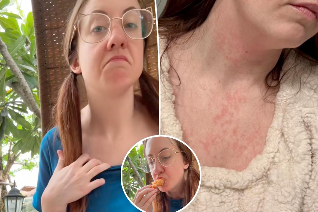 Severe 'allergies' forced woman to leave the US — | Lifestyle News