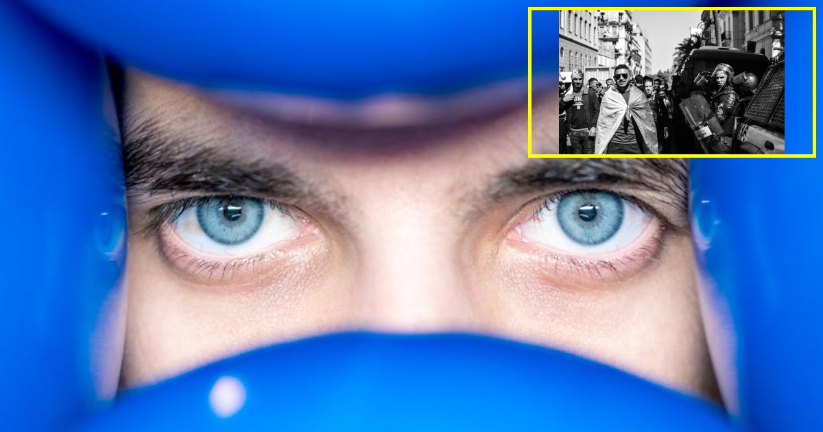 Man with severe nose growth unable to kiss wife shares crucial advice...