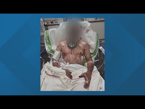 Mark Sanchez stabbing update | NFL broadcaster