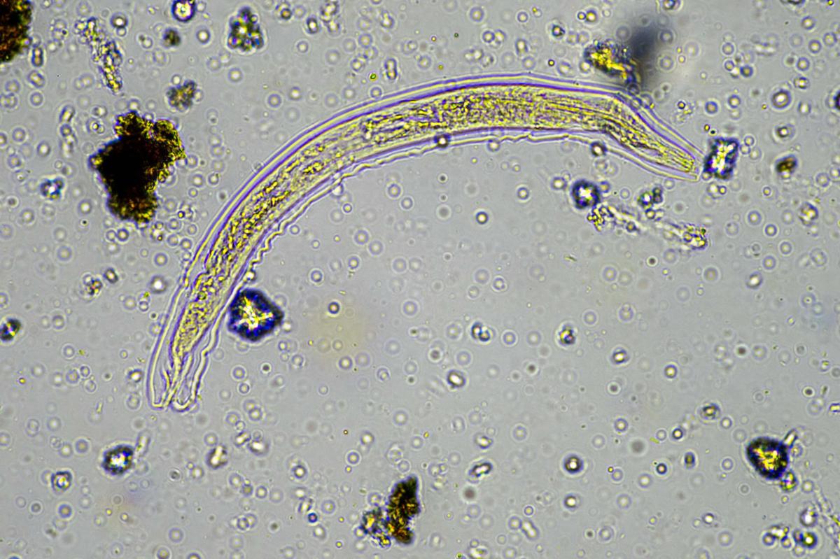 24,000-year-old frozen ‘zombie worm’ thawed by | Lifestyle News