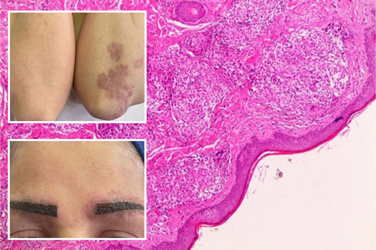 How a popular makeup trend triggered womans | Lifestyle News