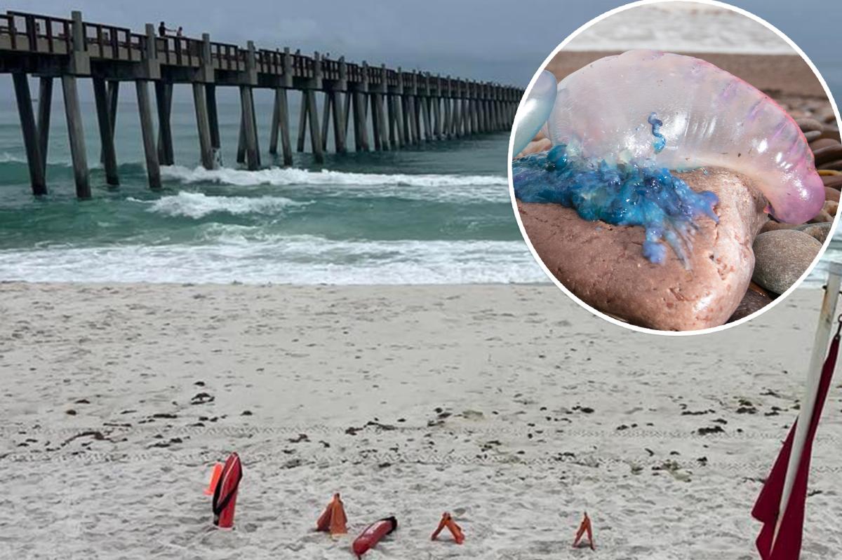 Stinging Portuguese man o war are invading | Lifestyle News