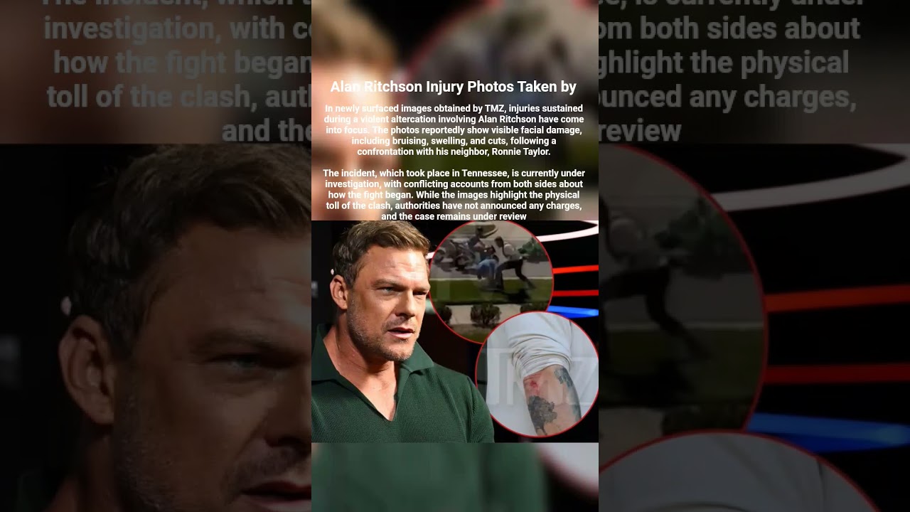 Alan Ritchson Injury Photos Taken by