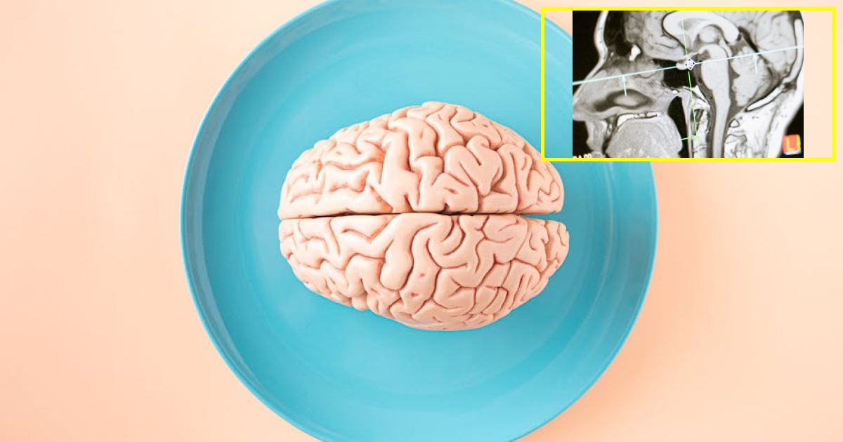 Brain scientist warns were heading for AI-fueled dementia crisis