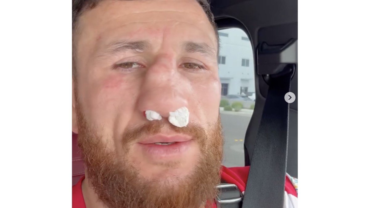 Merab Dvalishvili shatters nose in training
