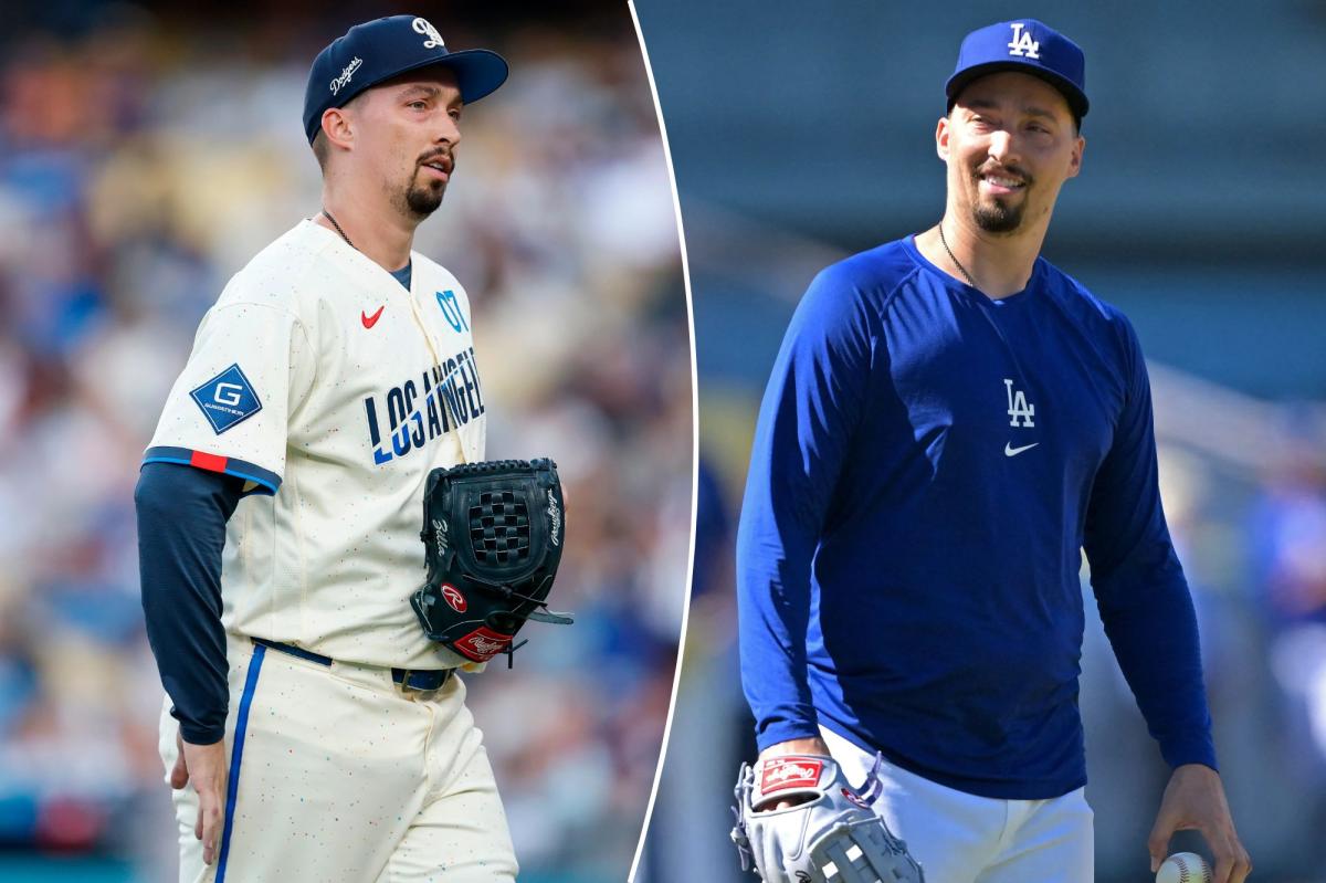 Dodgers’ Blake Snell to have elbow surgery | Sports News