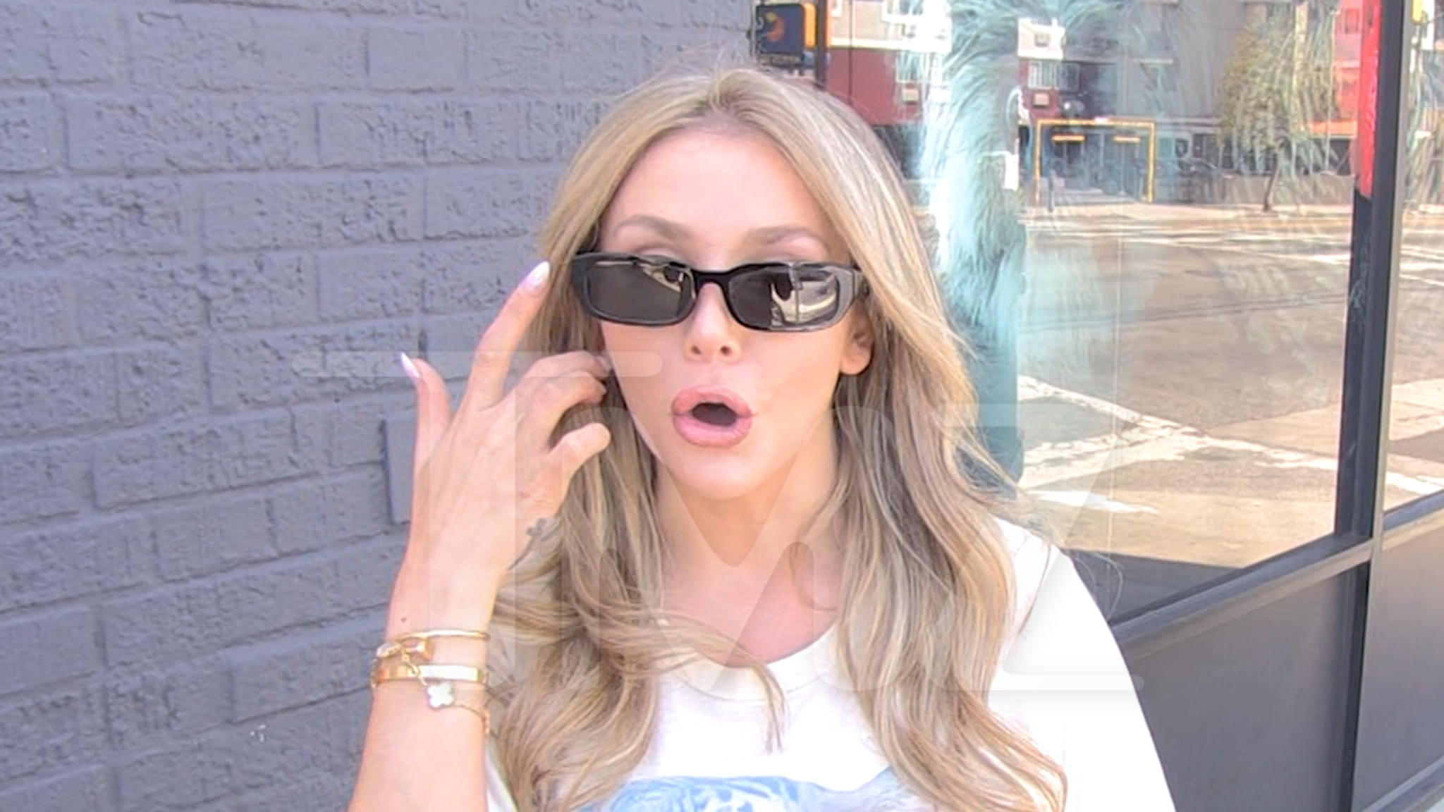 Courtney Stodden Shrugs Off visible injuryy Injury, Says